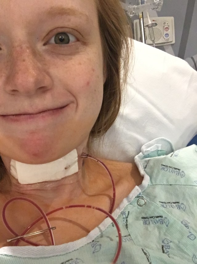 thyroidectomy surgery thyroidectomy surgery